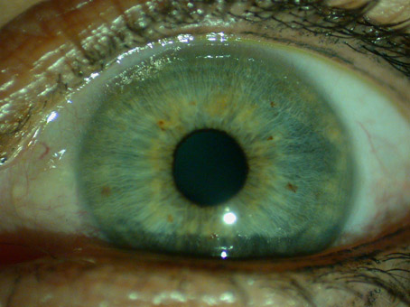 yeux vairons